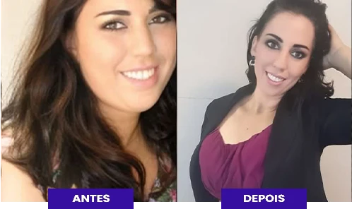 depoimnt2